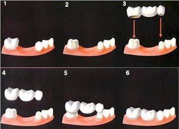 A picture of the stages in dental care.